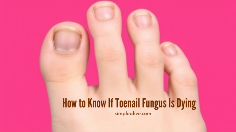 How to Know If Toenail Fungus Is Dying